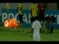 FootBall Player Finds Grenade on Field & Almost Losses His Hand